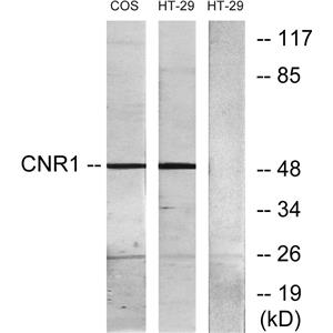 CB1兔多抗,CB1 Rabbit Polyclonal Antibody