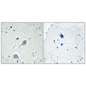 CB1兔多抗,CB1 Rabbit Polyclonal Antibody