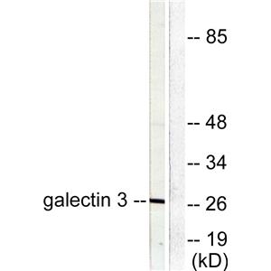 CBP 35兔多抗,CBP 35 Rabbit Polyclonal Antibody