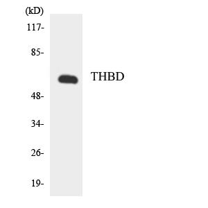 CD141兔多抗,CD141 Rabbit Polyclonal Antibody