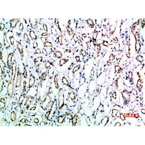 CD151兔多抗,CD151 Rabbit Polyclonal Antibody