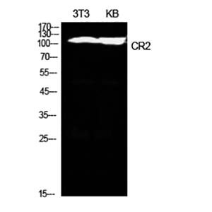 CD21兔多抗,CD21 Rabbit Polyclonal Antibody