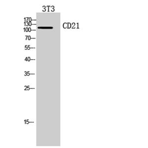 CD21兔多抗,CD21 Rabbit Polyclonal Antibody