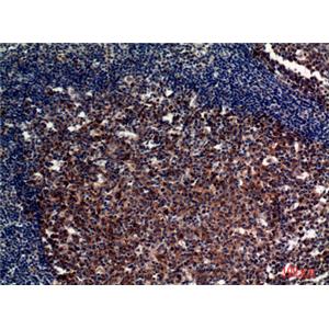 CD21兔多抗,CD21 Rabbit Polyclonal Antibody
