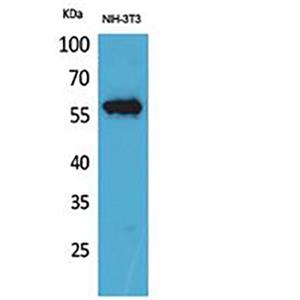 CD223兔多抗,CD223 Rabbit Polyclonal Antibody