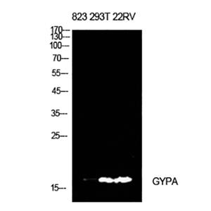 CD235a兔多抗,CD235a Rabbit Polyclonal Antibody