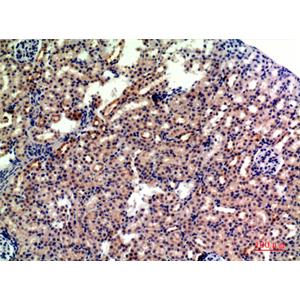 CD235a兔多抗,CD235a Rabbit Polyclonal Antibody