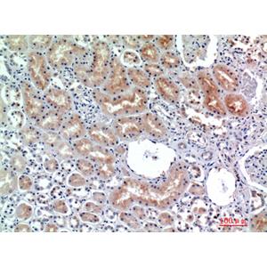CD26兔多抗,CD26 Rabbit Polyclonal Antibody