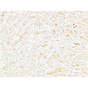 CD26兔多抗,CD26 Rabbit Polyclonal Antibody