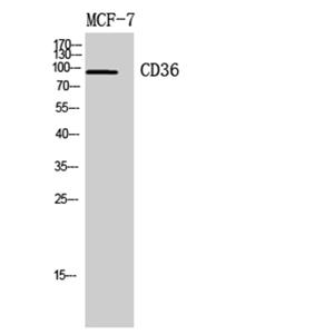 CD36兔多抗,CD36 Rabbit Polyclonal Antibody