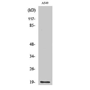CD3-δ兔多抗,CD3-δ Rabbit Polyclonal Antibody