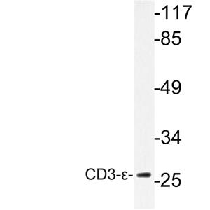 CD3-ε兔多抗,CD3-ε Rabbit Polyclonal Antibody