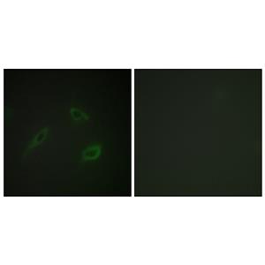 CD4兔多抗,CD4 Rabbit Polyclonal Antibody