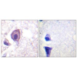 CD4兔多抗,CD4 Rabbit Polyclonal Antibody