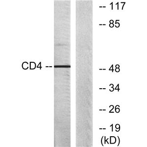 CD4兔多抗,CD4 Rabbit Polyclonal Antibody