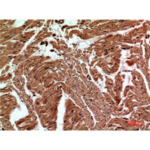 CD59兔多抗,CD59 Rabbit Polyclonal Antibody