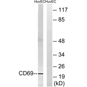 CD69兔多抗,CD69 Rabbit Polyclonal Antibody
