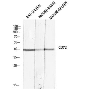 CD72兔多抗,CD72 Rabbit Polyclonal Antibody