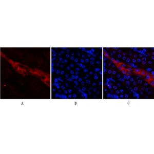 CD81兔多抗,CD81 Rabbit Polyclonal Antibody
