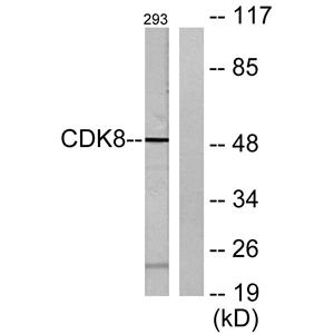 Cdk8兔多抗,Cdk8 Rabbit Polyclonal Antibody