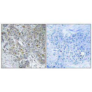 Cdk8兔多抗,Cdk8 Rabbit Polyclonal Antibody