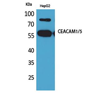 CEACAM1/5兔多抗,CEACAM1/5 Rabbit Polyclonal Antibody