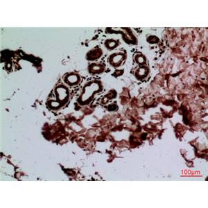 CEACAM1/5兔多抗,CEACAM1/5 Rabbit Polyclonal Antibody