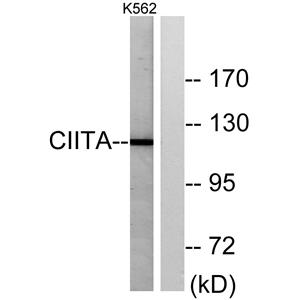 CIITA兔多抗,CIITA Rabbit Polyclonal Antibody