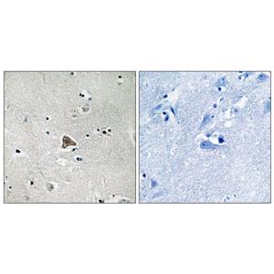 Claudin-4兔多抗,Claudin-4 Rabbit Polyclonal Antibody
