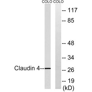 Claudin-4兔多抗,Claudin-4 Rabbit Polyclonal Antibody