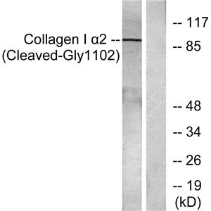 Cleaved-COL1A2 (G1102)兔多抗,Cleaved-COL1A2 (G1102) Rabbit Polyclonal Antibody