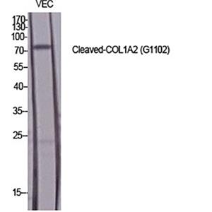 Cleaved-COL1A2 (G1102)兔多抗,Cleaved-COL1A2 (G1102) Rabbit Polyclonal Antibody