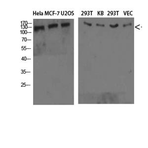 Collagen IV 兔多抗,Collagen IV  Rabbit Polyclonal Antibody