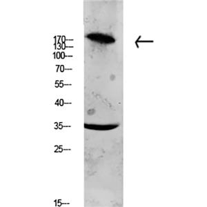 Collagen XI α1兔多抗,Collagen XI α1 Rabbit Polyclonal Antibody