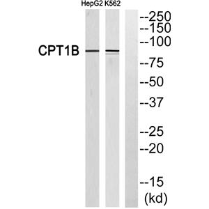 CPTI-M兔多抗,CPTI-M Rabbit Polyclonal Antibody