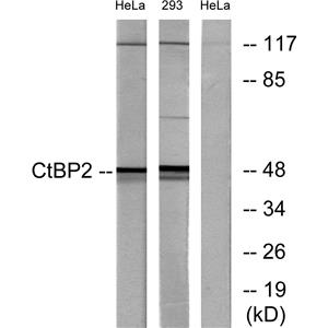 CtBP2兔多抗,CtBP2 Rabbit Polyclonal Antibody