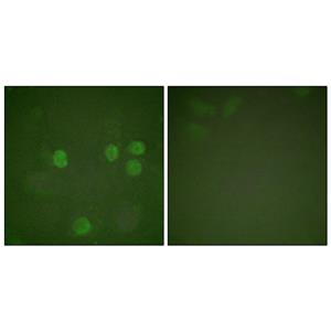 Cyclin B1兔多抗,Cyclin B1 Rabbit Polyclonal Antibody