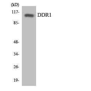 DDR1兔多抗,DDR1 Rabbit Polyclonal Antibody