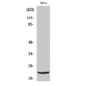 DJ-1兔多抗,DJ-1 Rabbit Polyclonal Antibody