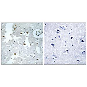 DJ-1兔多抗,DJ-1 Rabbit Polyclonal Antibody