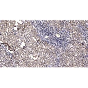 DOCK 2 Rabbit Polyclonal Antibody | 兔多抗 | EnkiLife恩玑生命