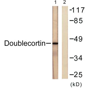 Doublecortin兔多抗,Doublecortin Rabbit Polyclonal Antibody