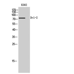 Dvl-2兔多抗,Dvl-2 Rabbit Polyclonal Antibody