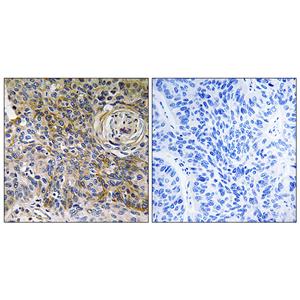 EMMPRIN兔多抗,EMMPRIN Rabbit Polyclonal Antibody