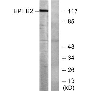 EphB2兔多抗,EphB2 Rabbit Polyclonal Antibody