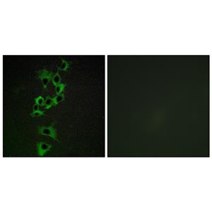 ErbB-4兔多抗,ErbB-4 Rabbit Polyclonal Antibody