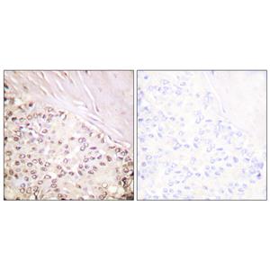 FANCD2兔多抗,FANCD2 Rabbit Polyclonal Antibody