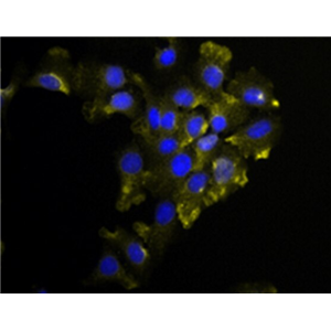 大鼠血管外膜成纤维细胞,Rat vascular adventitia fibroblasts