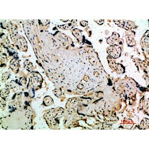 Flt-4兔多抗,Flt-4 Rabbit Polyclonal Antibody