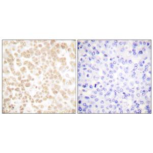 FOSL2 Rabbit Polyclonal Antibody | 兔多抗 | EnkiLife恩玑生命